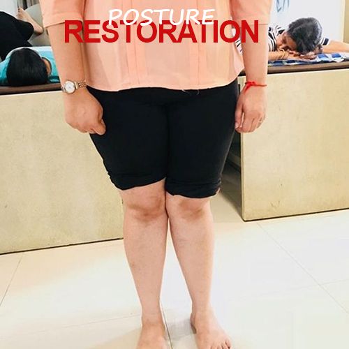 Posture Restoration